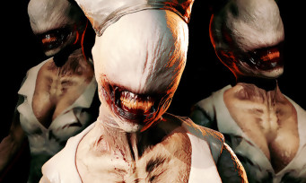 Bloober Team : le studio va-t-il enfin annoncer le remake de Silent Hill 2 ?