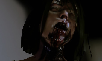 Allison Road