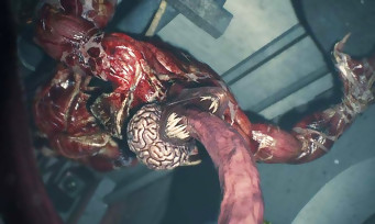Resident Evil 2 :une nouvelle vidéo flippante avec les Lickers