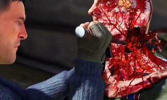 Sniper Elite 5 : un nouveau trailer qui enchaîne les perforations d'organes