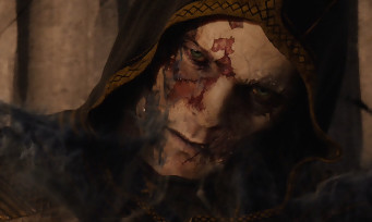 The Elder Scrolls Online Tamriel Unlimited : nouvelle vidéo de gameplay