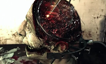 The Evil Within : des images bien dégueulasses