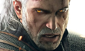 Xbox One : deux packs The Witcher 3 annoncés