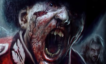 ZombiU listé sur PS4 et Xbox One en Asie
